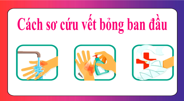 Cách sơ cứu vết bỏng ban đầu